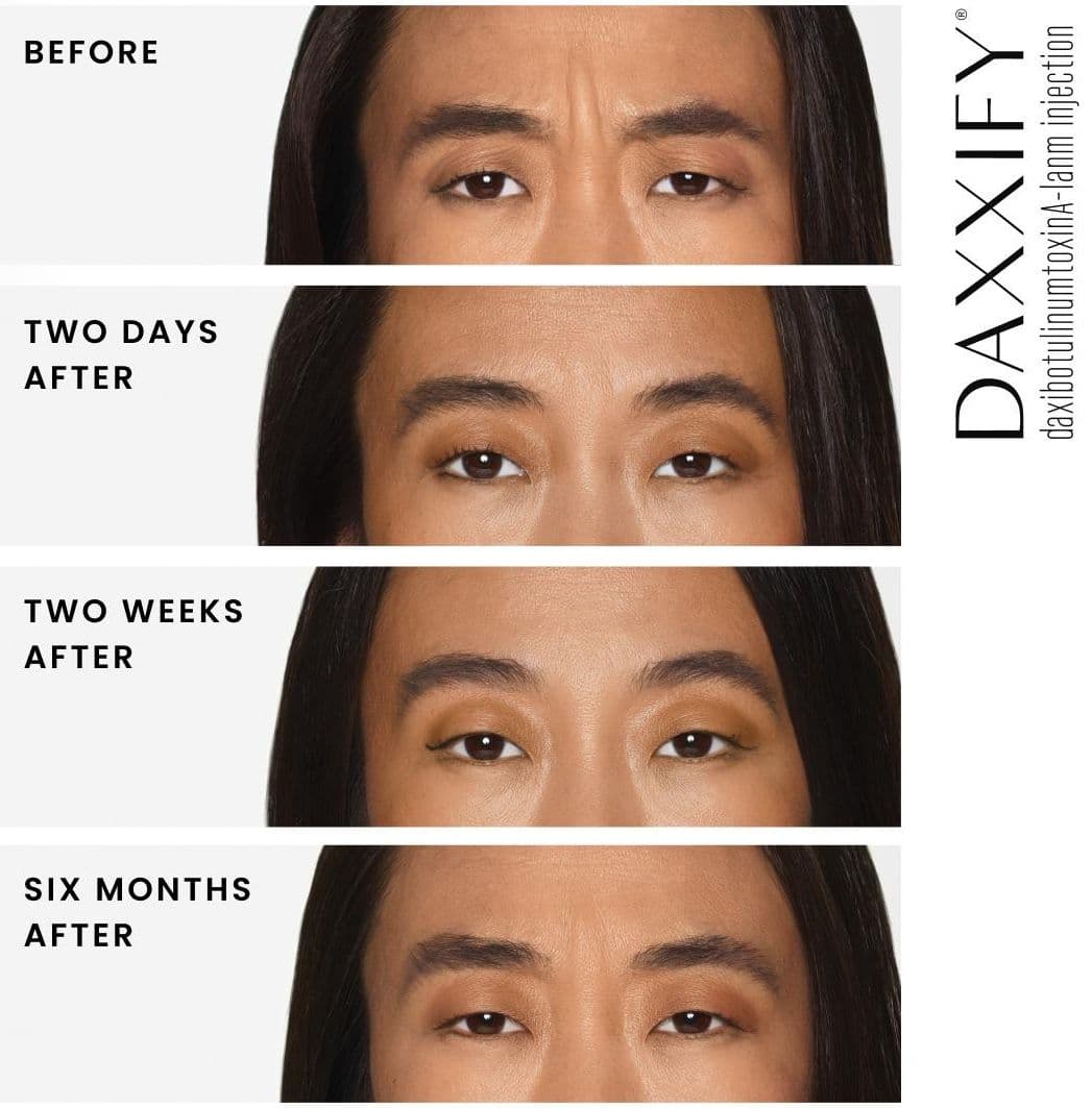 Before and After Day 1 through 6 months