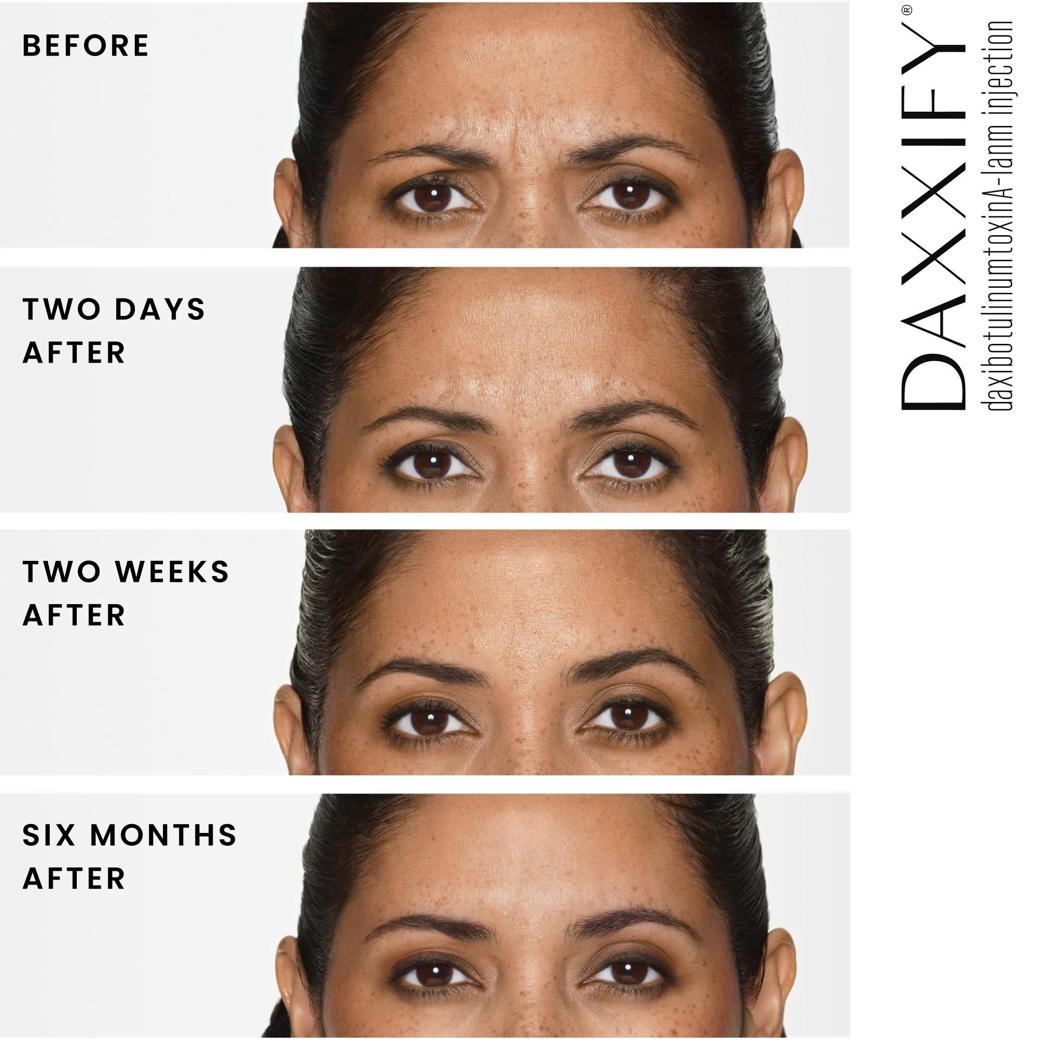 Before and After Day 1 through 6 months part 2